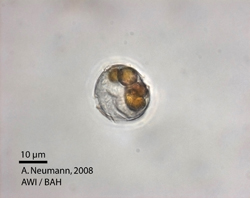 P. danica: food vacuoles with Rhodomonas