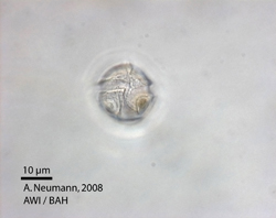 P. danica: surface with sulcus