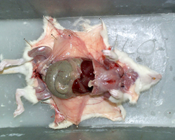abdomen open