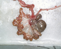 intestine